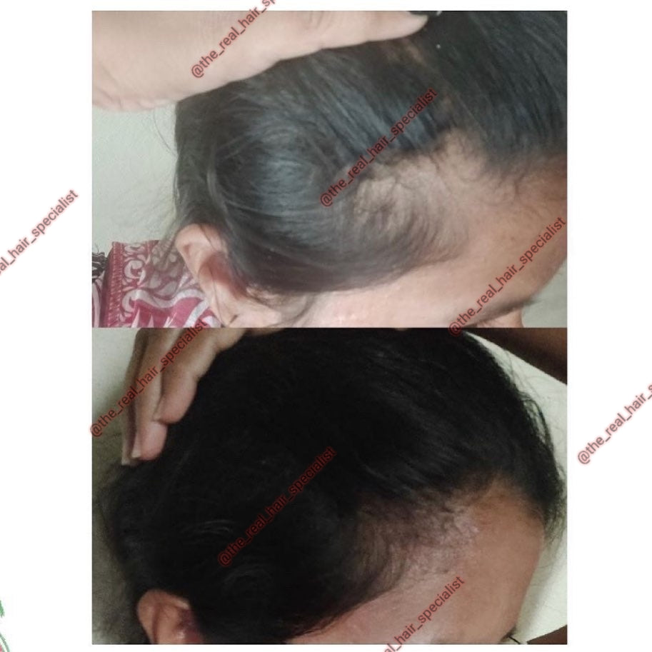 Grow out herbal hair oil