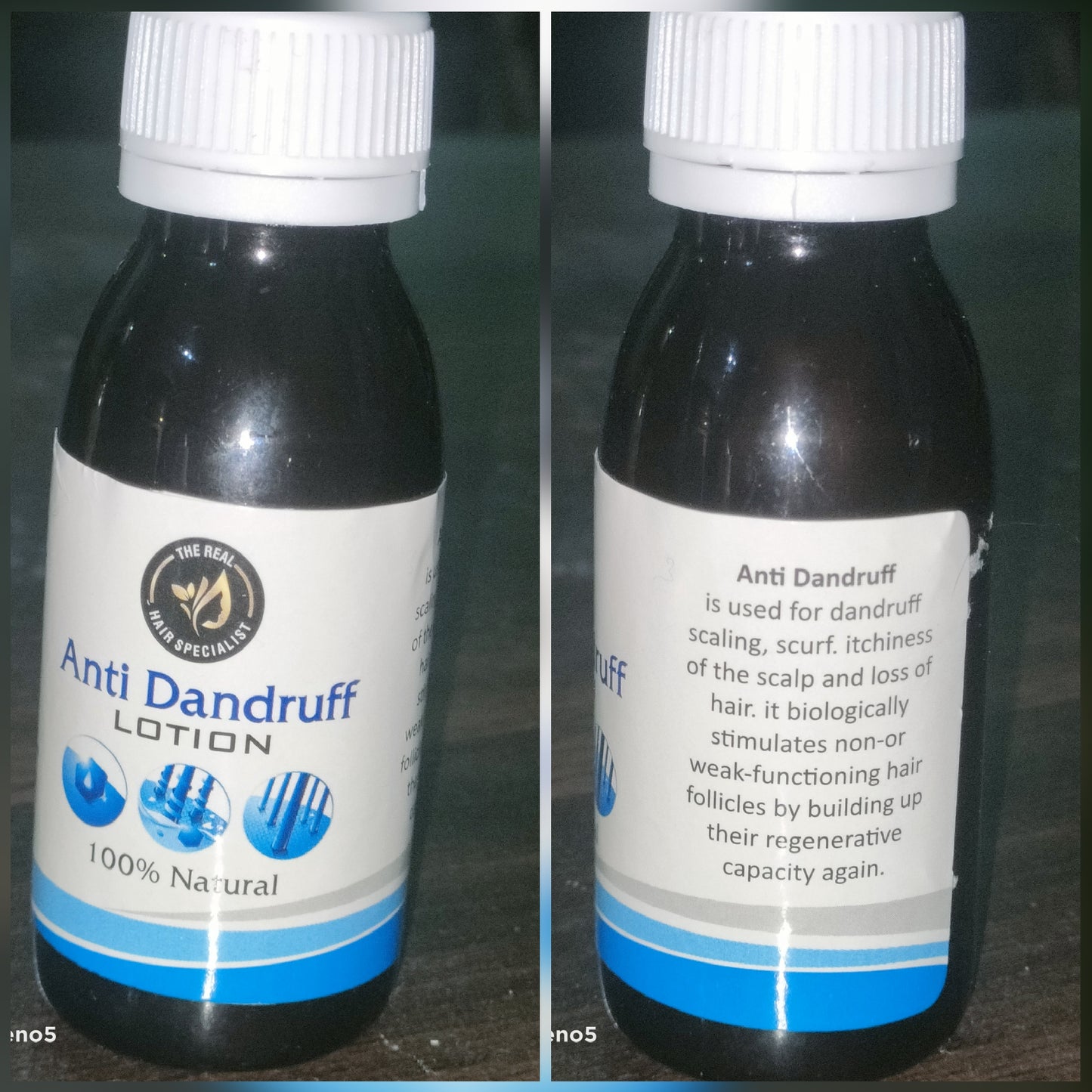 Anti dandruff lotion