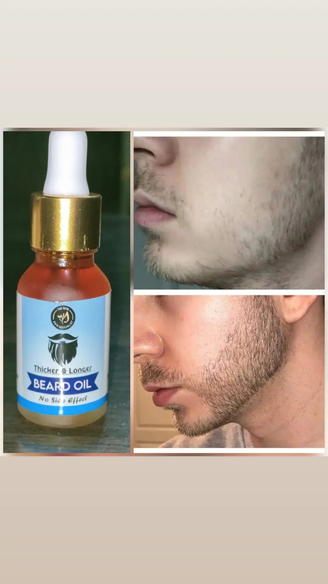 Beard Growth Oil