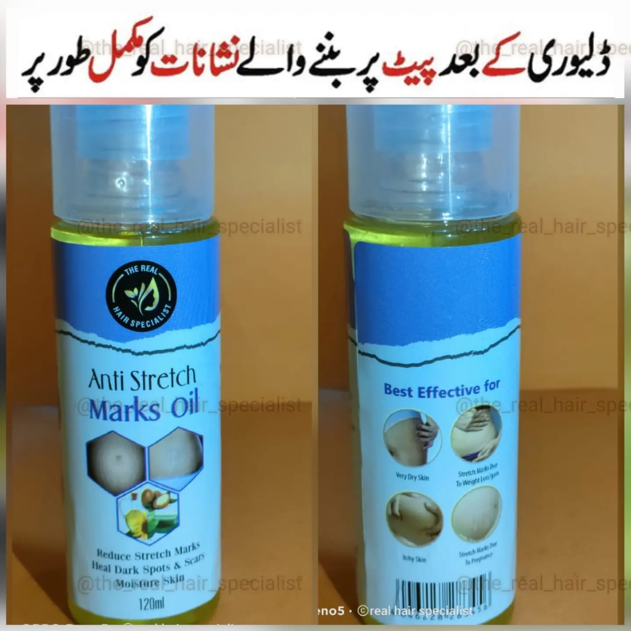 Stretch Marks Oil