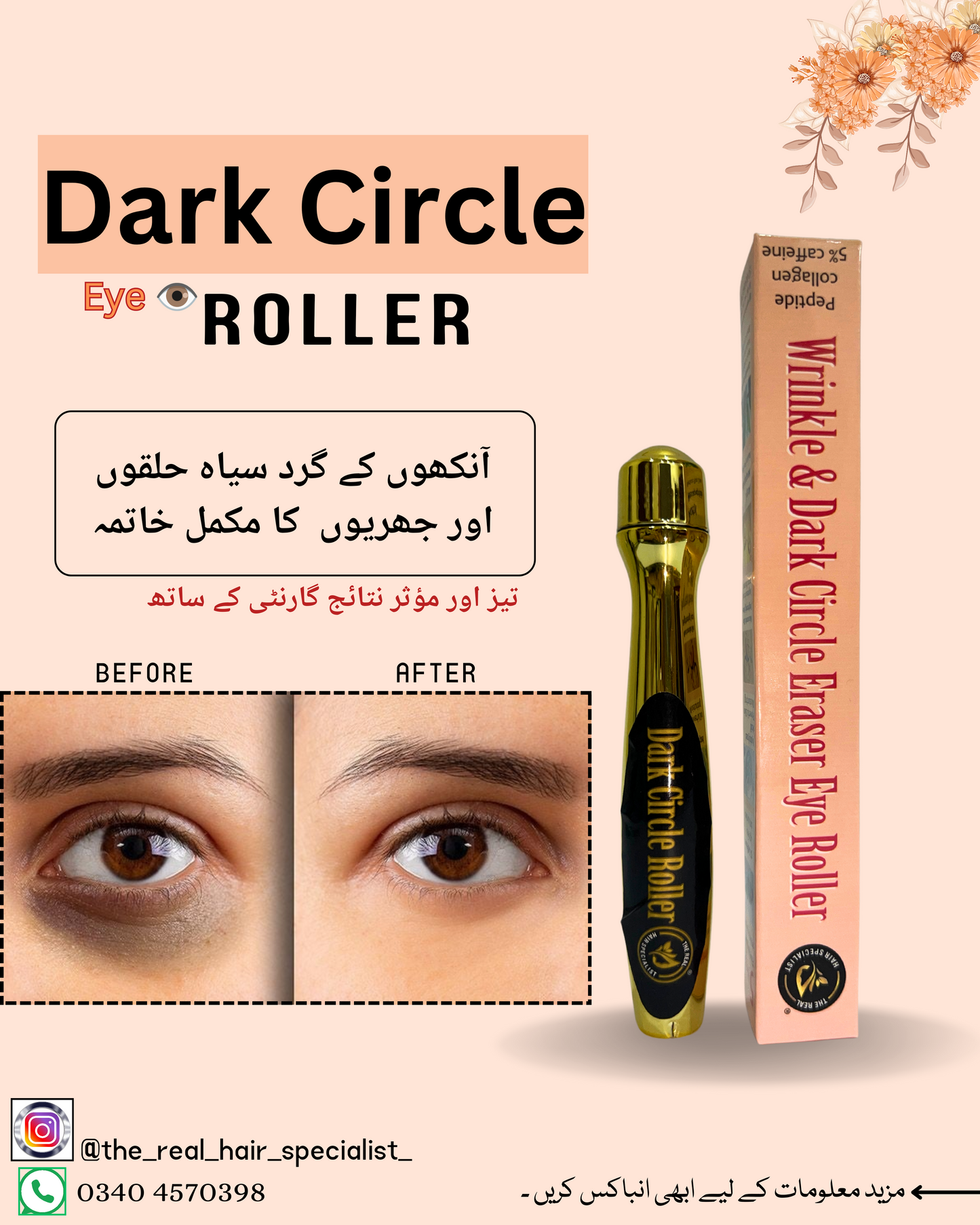 Dark circle and wrinkle remover Roller